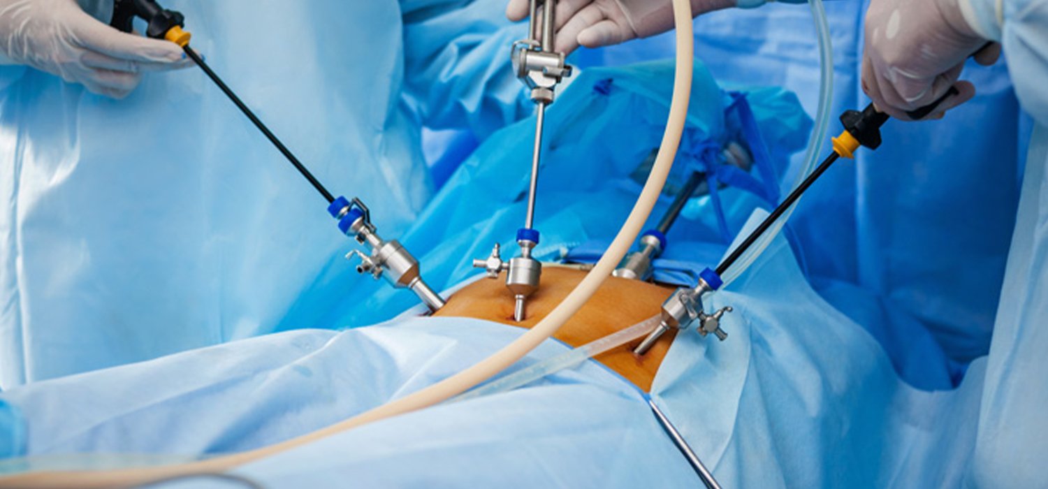 Modern Oncology Surgery | Capital Hospital