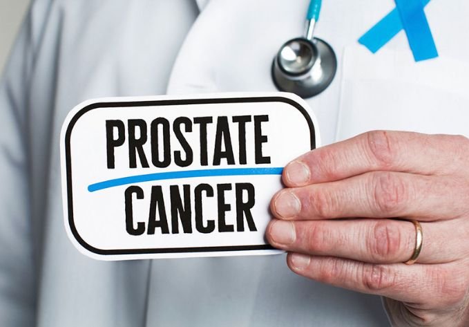 Common Signs of Prostate Cancer and Effective Treatment Options